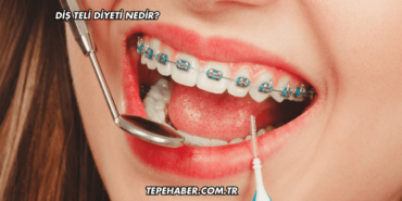 Diş Teli Diyeti Nedir?