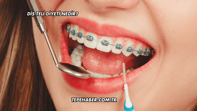 Diş Teli Diyeti Nedir?
