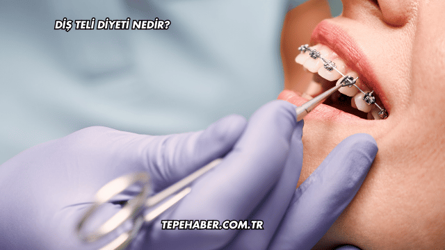 Diş Teli Diyeti Nedir?