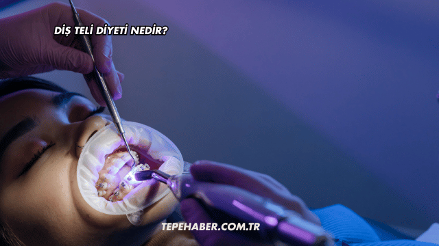 Diş Teli Diyeti Nedir?